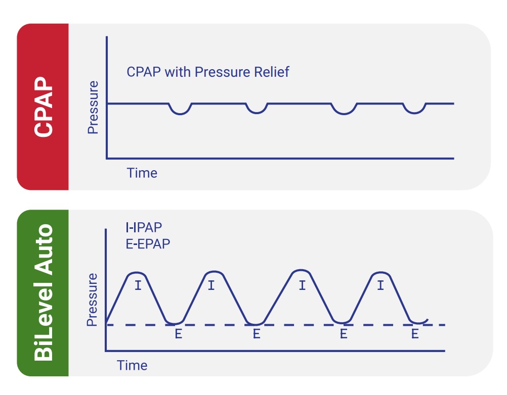 Comfortable Alternative to CPAP
