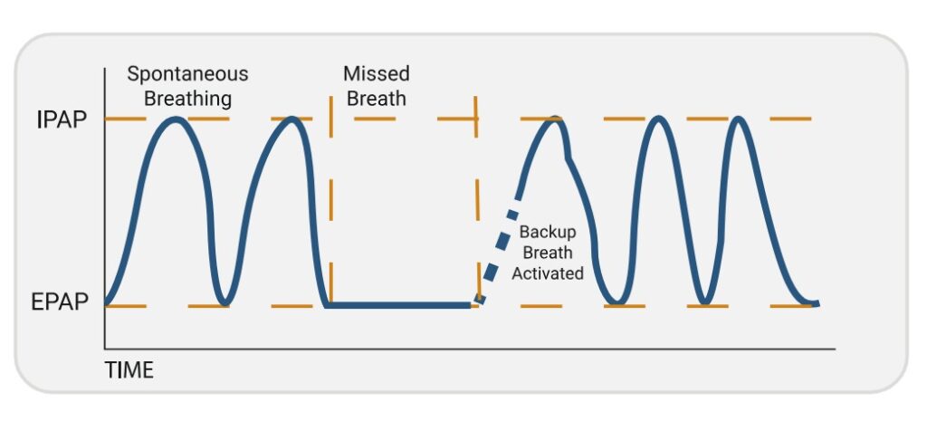Backup Breath Rate